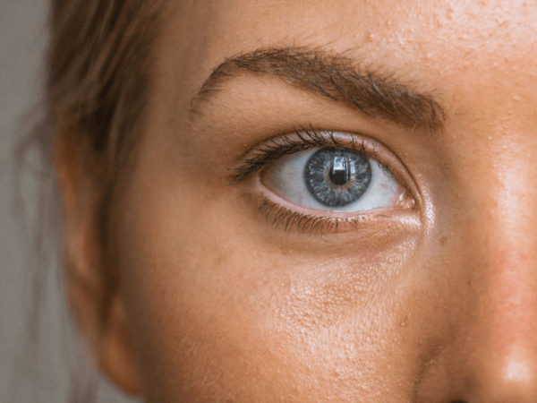 The Appeal of Under-Eye Rejuvenation: Renew Your Eyes, Refresh Your Look